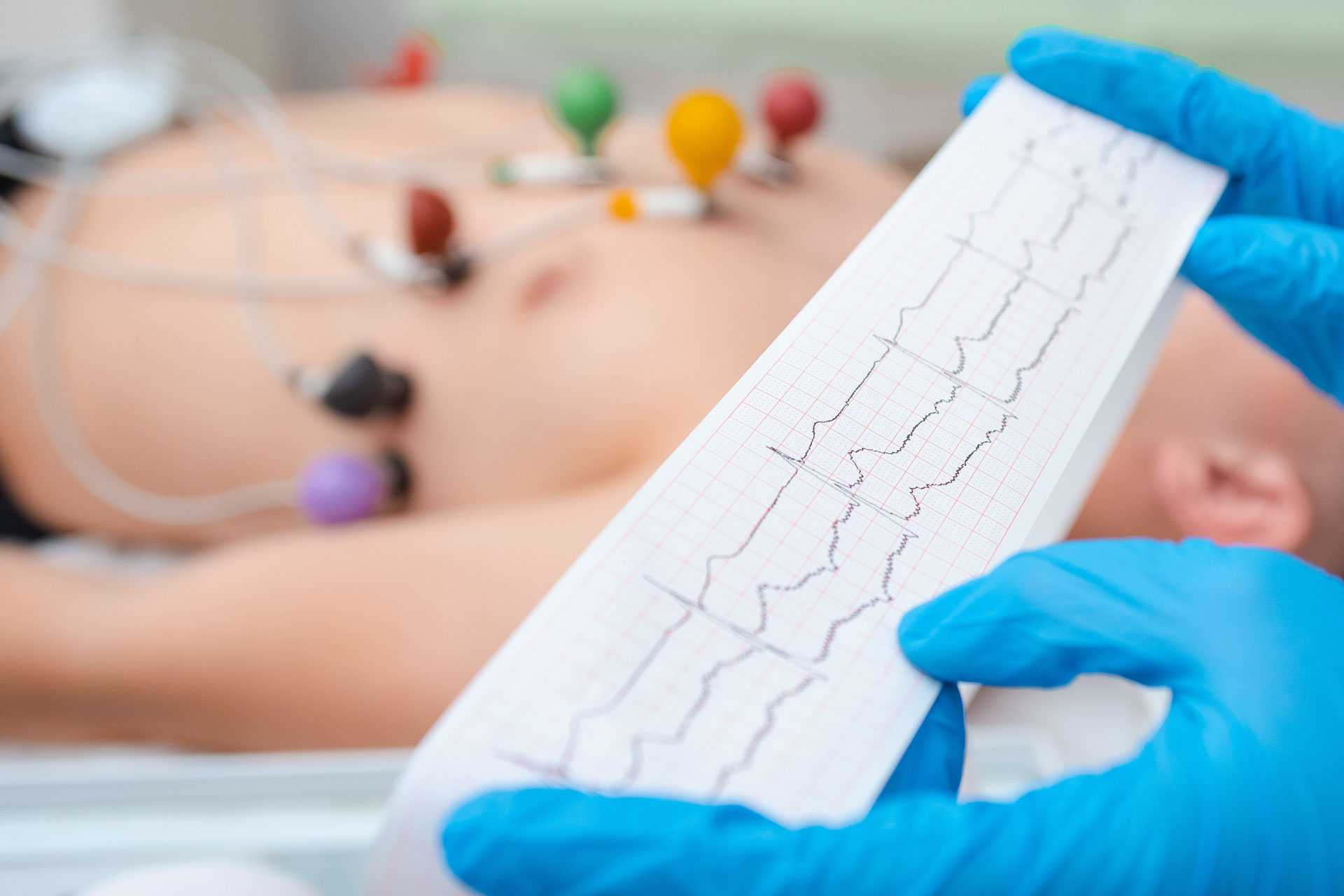 Eletrocardiograma